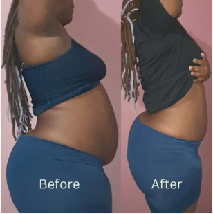 Slim Patch – Le patch naturel pour un ventre plus plat